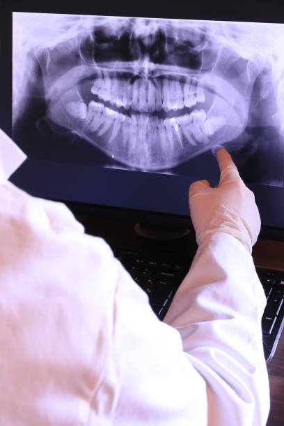 Best Emergency Dental Extractions in Duncan, OK